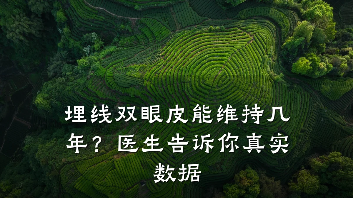 埋线双眼皮能维持几年?医生告诉你真实数据